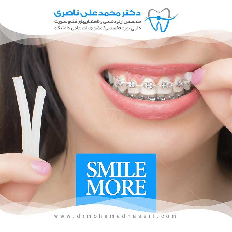 نمونه کار ارتودنسی دندان توسط دکتر محمد علی ناصری