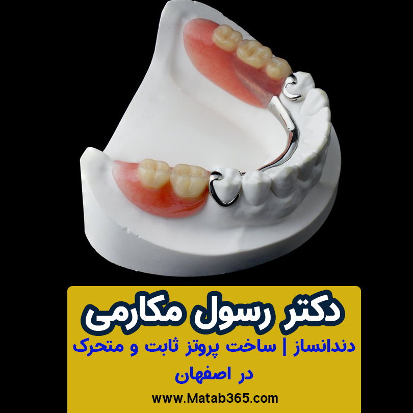 دکتر رسول مکارمی|دندانسازی در اصفهان،پروتز ثابت و متحرک