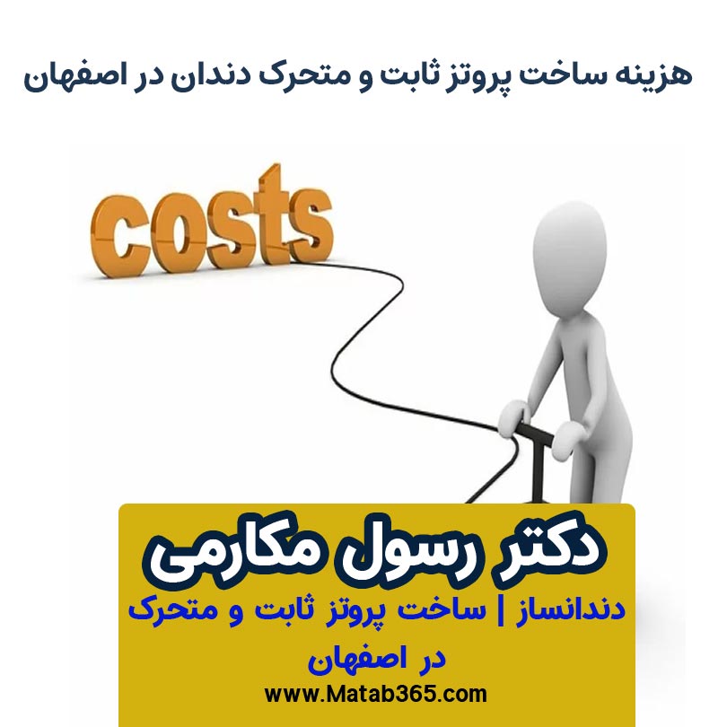 هزینه ساخت پروتز ثابت و متحرک دندان در اصفهان