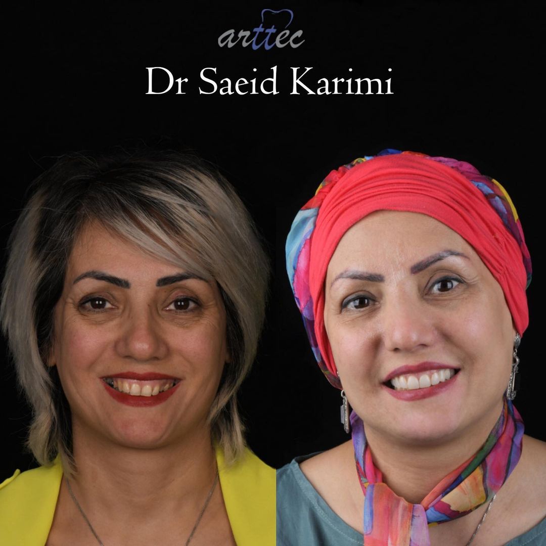 اصلاح طرح لبخند دکتر سعید کریمی دندانپزشک زیبایی