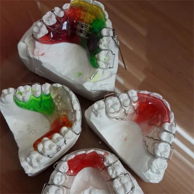 نمونه کار لابراتوار دندانسازی اسپید| دکتر ذبیح الله میر عبدالله