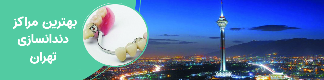 بهترین مراکز دندانسازی در تهران