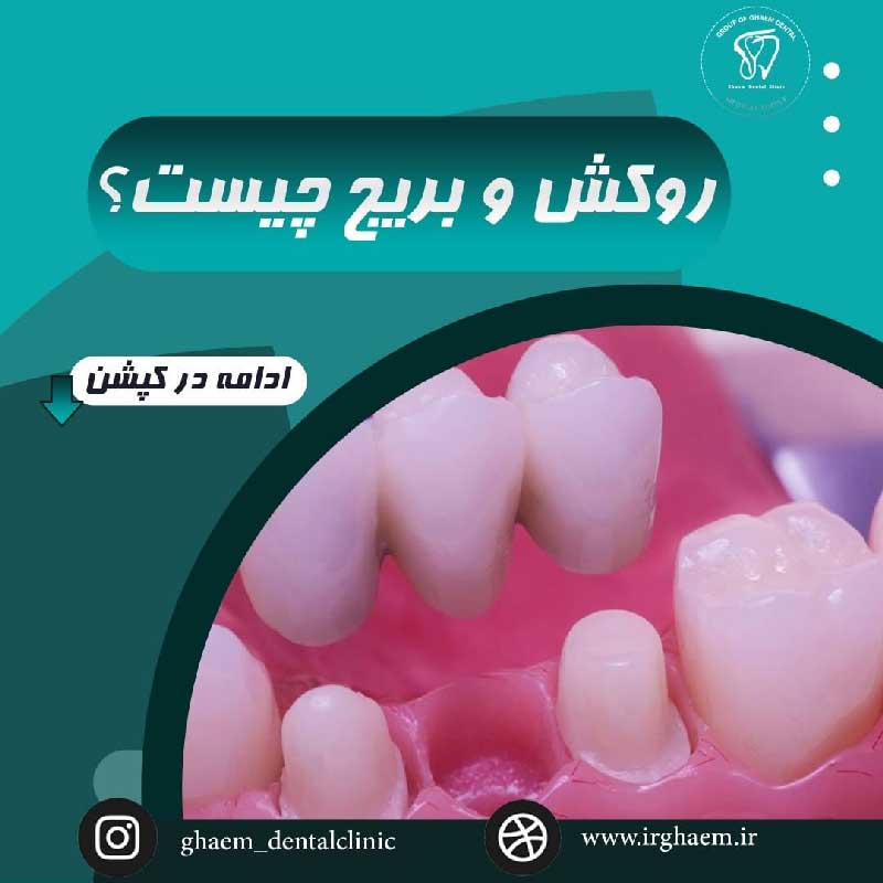 نمونه کار کلینیک دندانپزشکی قائم شیراز