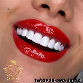 کلینیک زیبایی دندانپزشکی دایان تهران