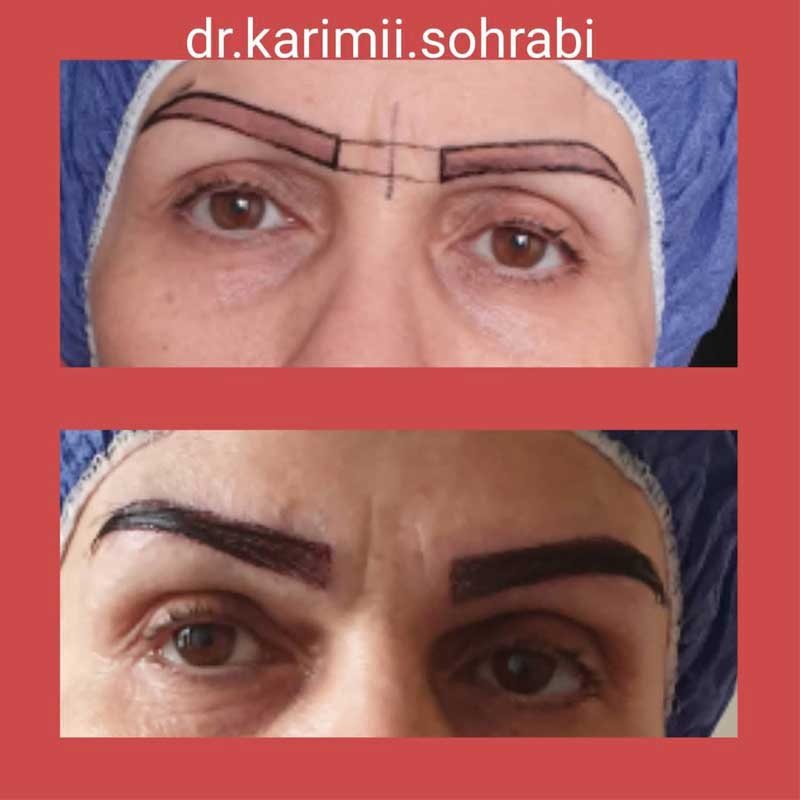 نمونه کار دکتر مژگان کریمی | متخصص پوست مو زیبایی در تهران
