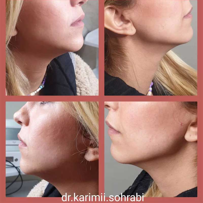 نمونه کار دکتر مژگان کریمی | متخصص پوست مو زیبایی در تهران