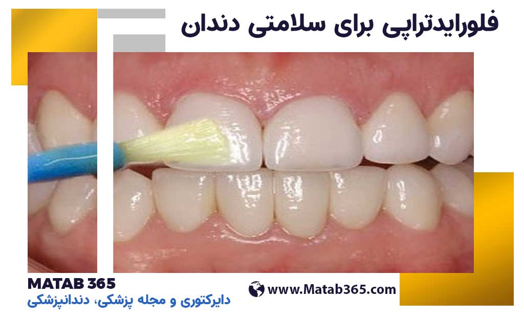 فلورایدتراپی برای سلامتی دندان