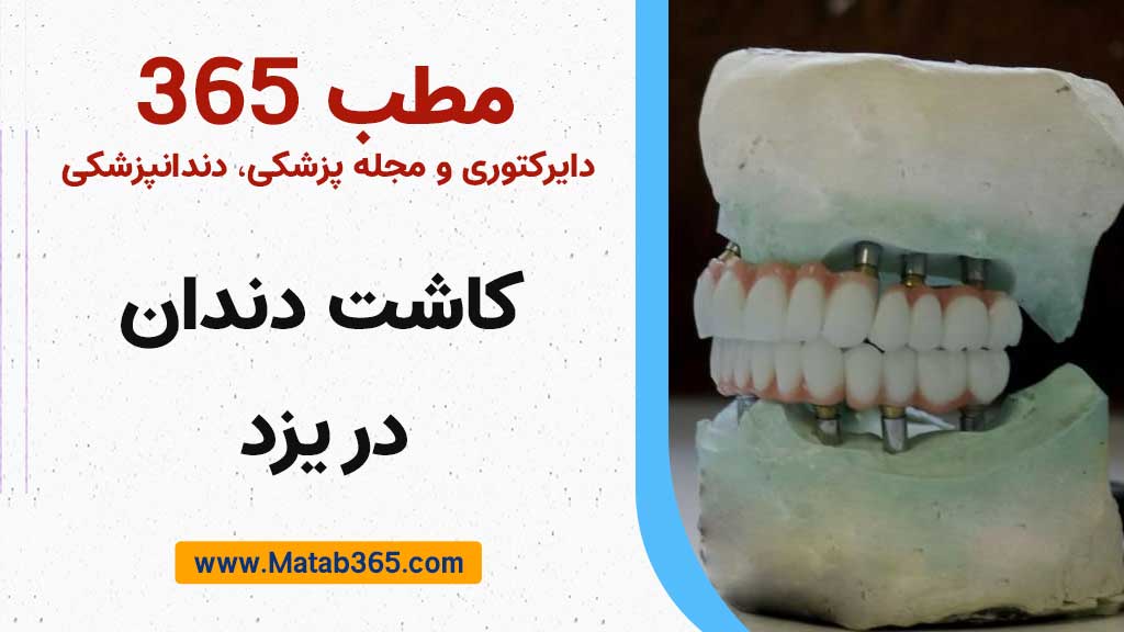 کاشت دندان در یزد توسط متخصص ایمپلنت در یزد