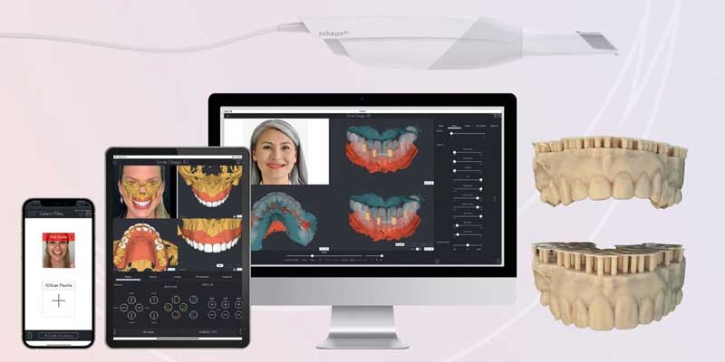 اسکن دندان برای کاشت دندان دیجیتال