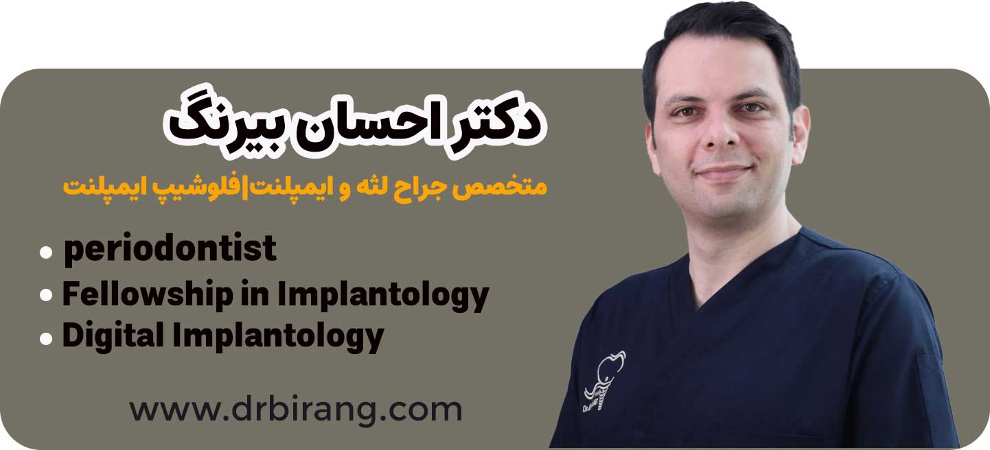 دکتر احسان بیرنگ متخصص ایمپلنت فوری در تهران