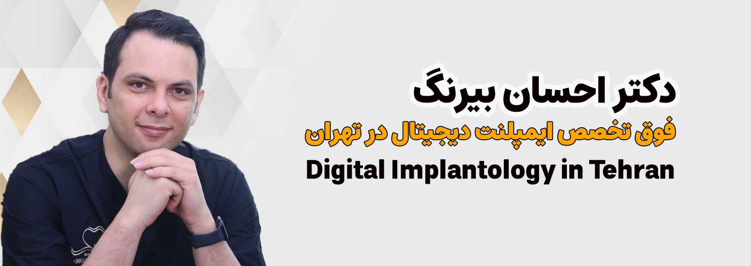 دکتر احسان بیرنگ متخصص ایمپلنت دیجیتال در تهران