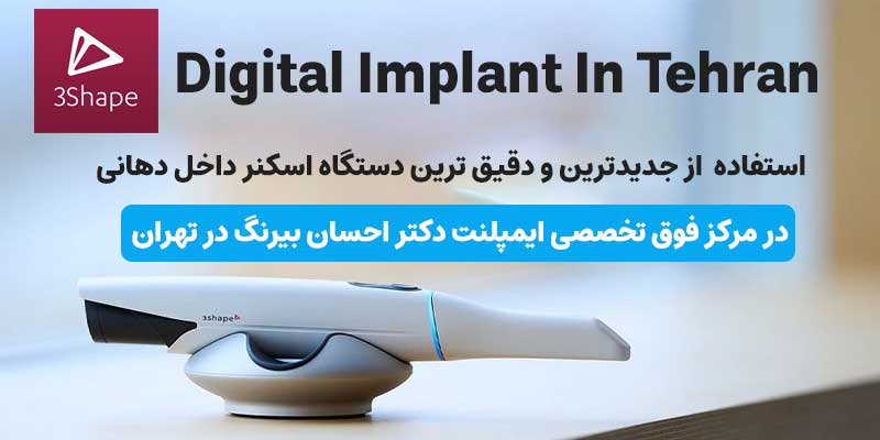 جدیدترین دستگاه اسکنر در مطب دکتر بیرنگ متخصص ایمپلنت دیجیتال در تهران