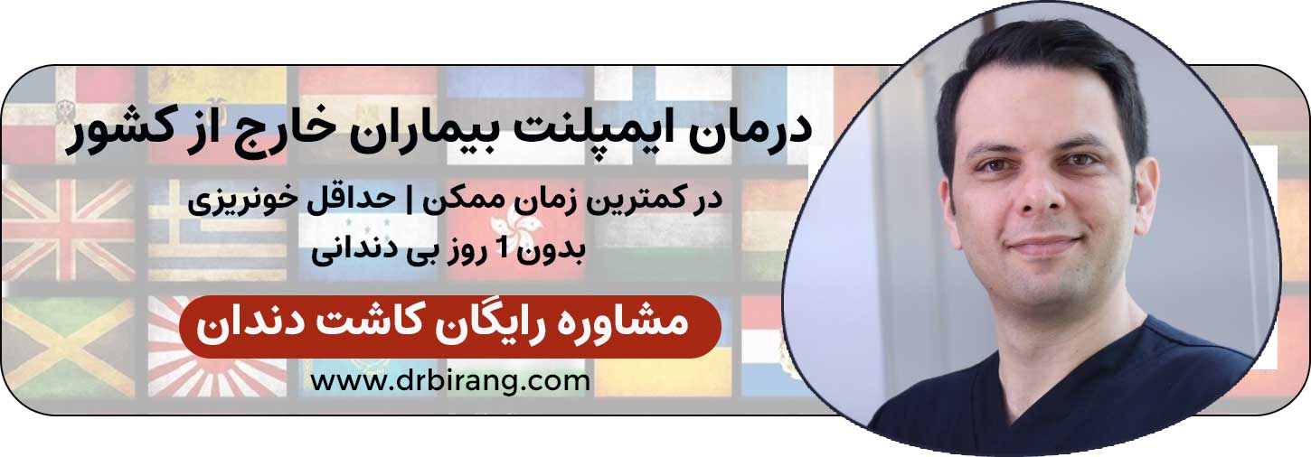 ارتباط با دکتر بیرنگ برای ایمپلنت دیجیتال در تهران
