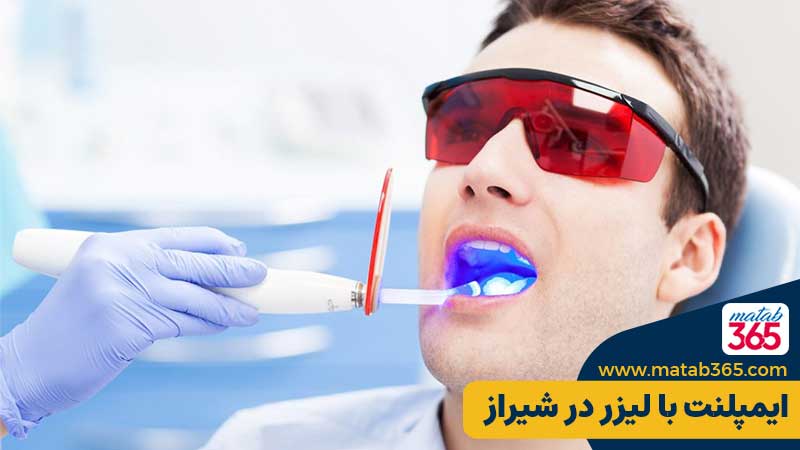 کاشت دندان با لیزر در شیراز