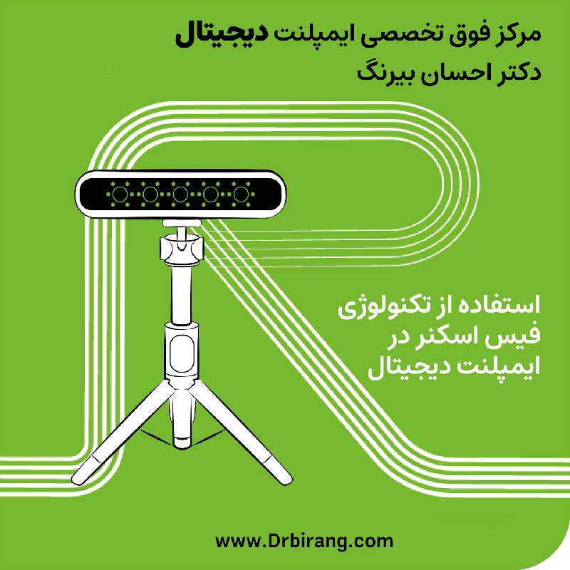 کاشت ایمپلنت دیجیتال در تهران با استفاده از فیس اسکنر