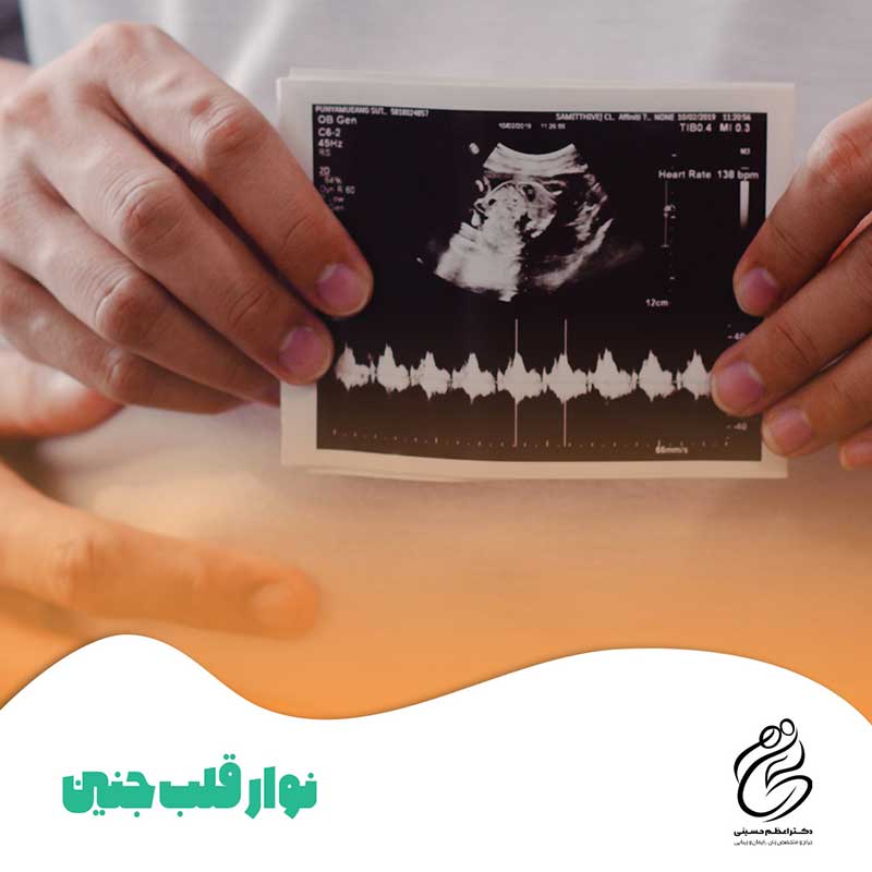 انجام نوار قلب جنین در تهران | دکتر اعظم حسینی