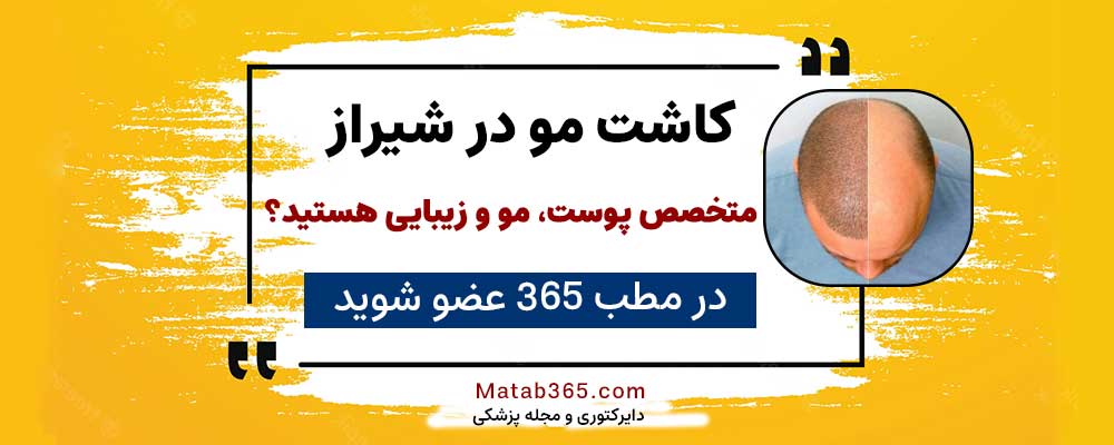 برای ثبت نام جهت انجام کاشت مو در شیراز کلیک کنید