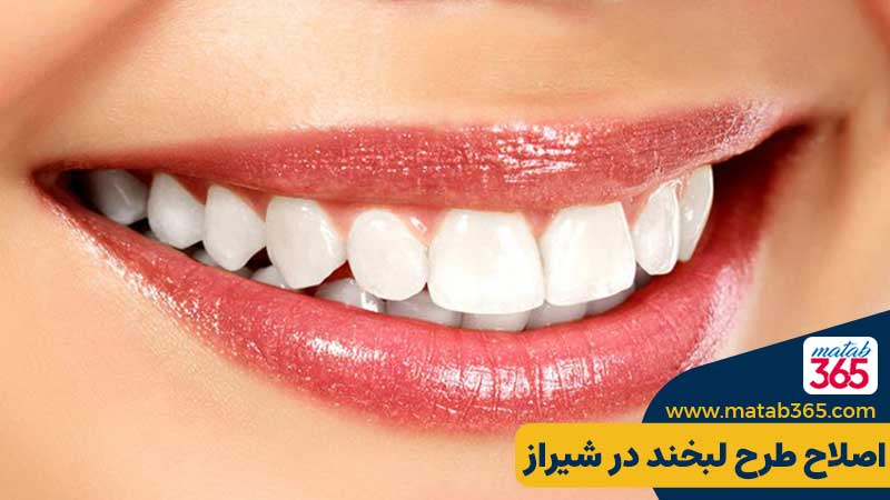 اصلاح طرح لبخند در شیراز