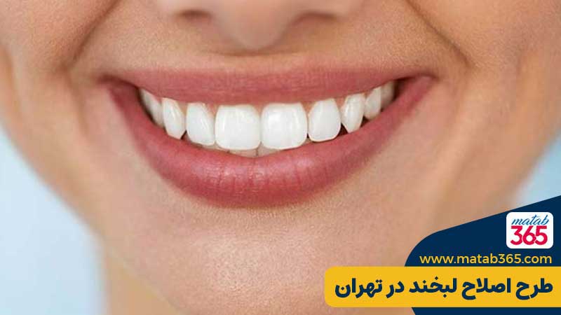 طرح اصلاح لبخند در تهران