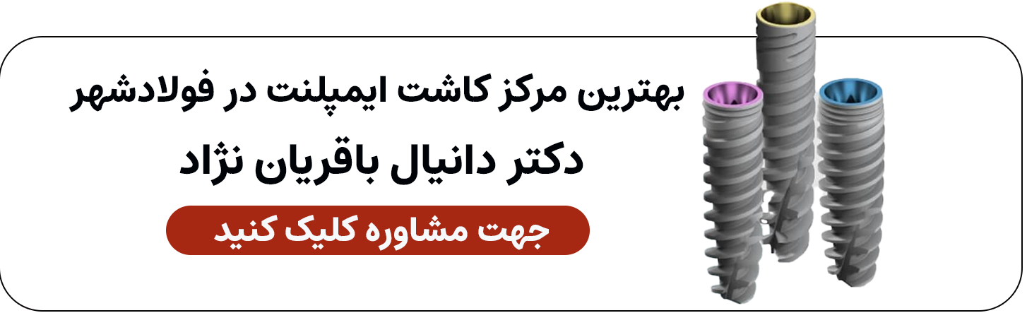 کاشت ایمپلنت در فولادشهر اصفهان