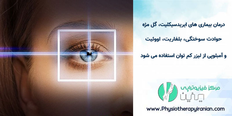 تأثیر لیزر کم توان روی عمل چشم 
