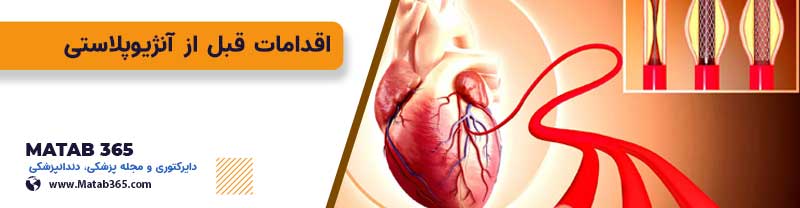 اقدامات قبل از آنژیوپلاستی