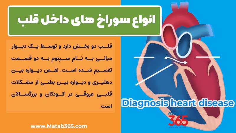 انواع سوراخ های داخل قلب