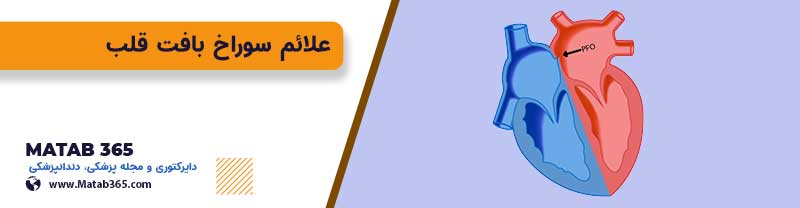 علائم سوراخ بافت قلب