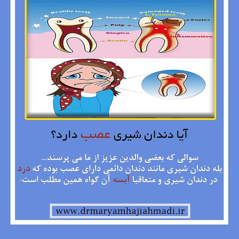 عصب کشی دندان کودکان توسط دکتر مریم حاجی احمدی