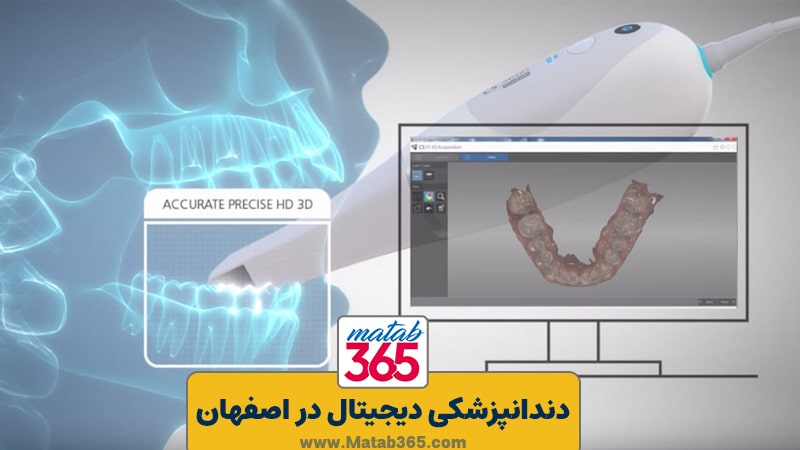 دندانپزشکی دیجیتال در اصفهان | مطب 365