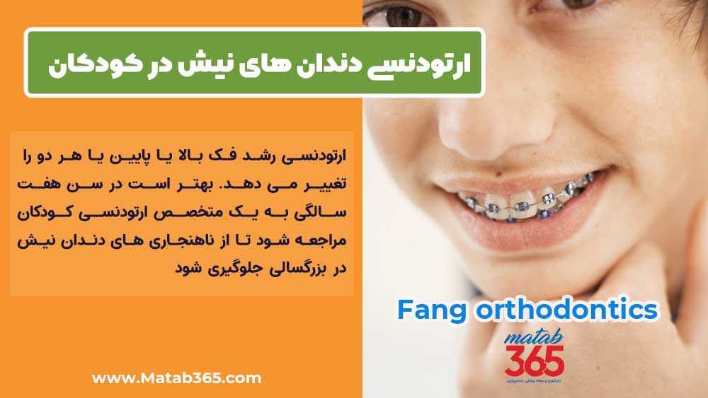 ارتودنسی دندان های نیش در کودکان