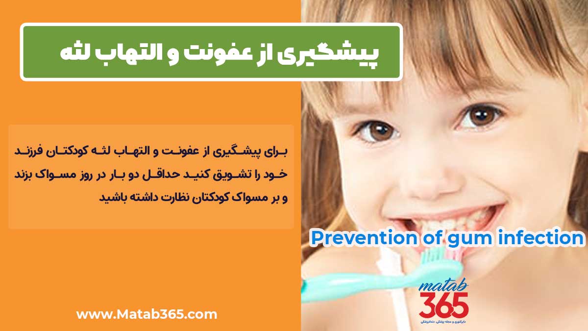 پیشگیری از التهاب و عفونت لثه کودک