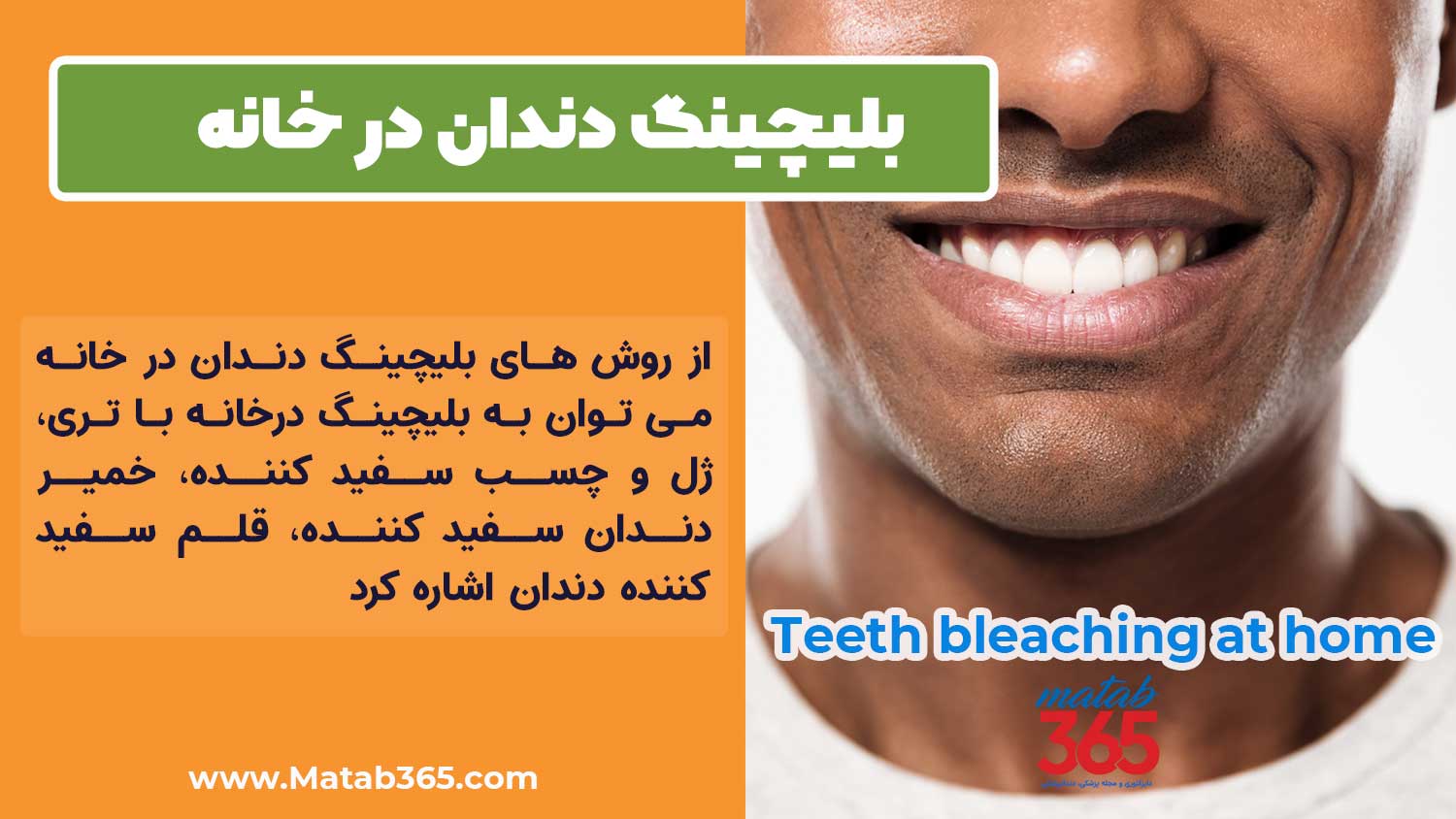 روش های بلیچینگ دندان در خانه
