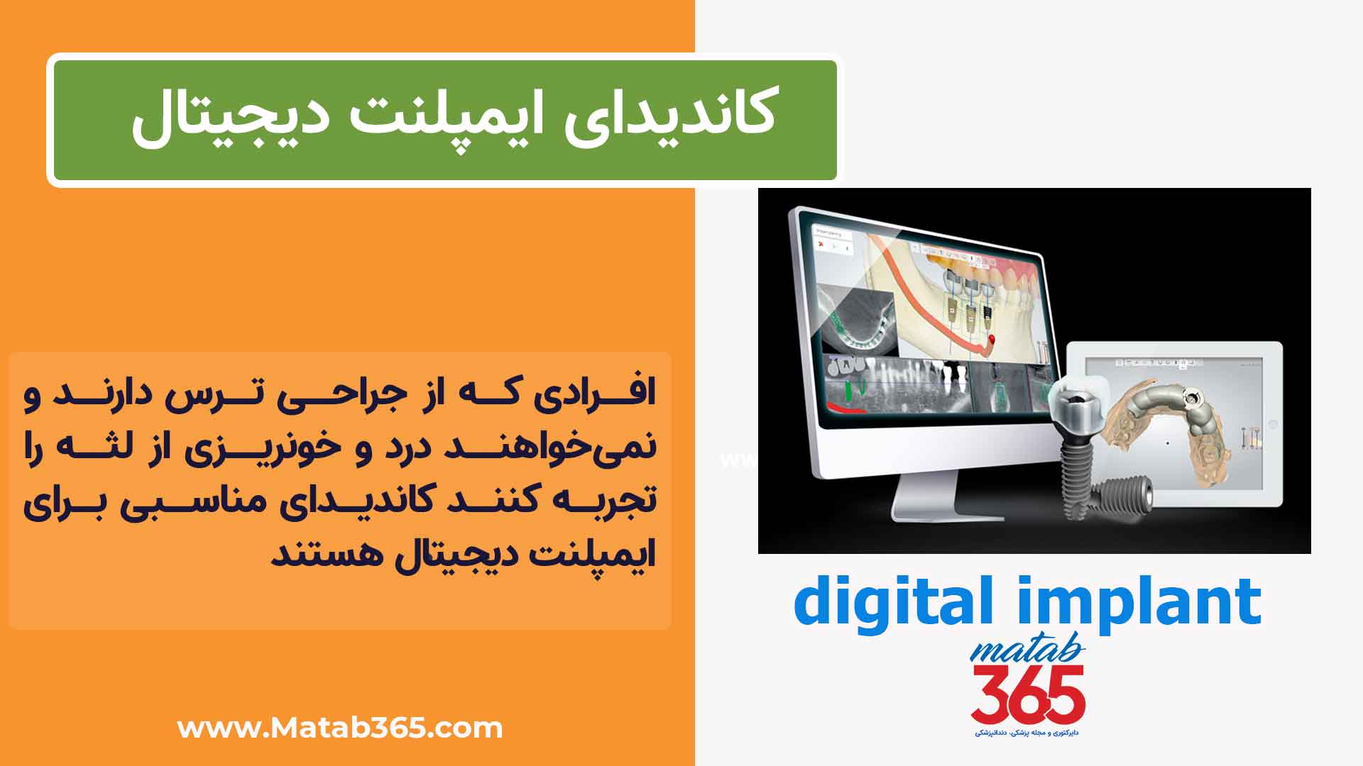 کاندیدای ایمپلنت دیجیتال