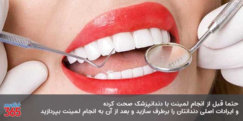 اقدامات قبل از لمینت دندان