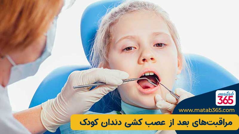 مراقبت بعد از عصب کشی دندان کودک