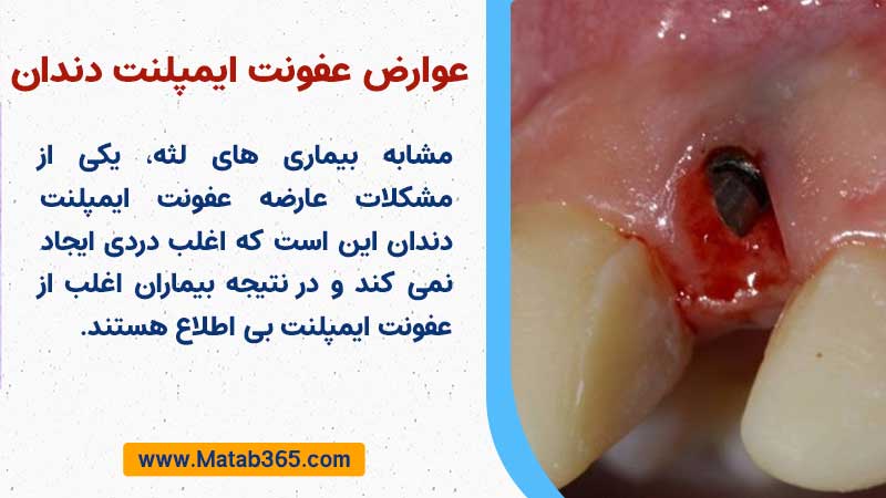 عوارض عفونت ایمپلنت دندان