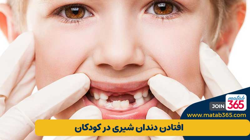 افتادن دندان شیری کودکان | مطب 365
