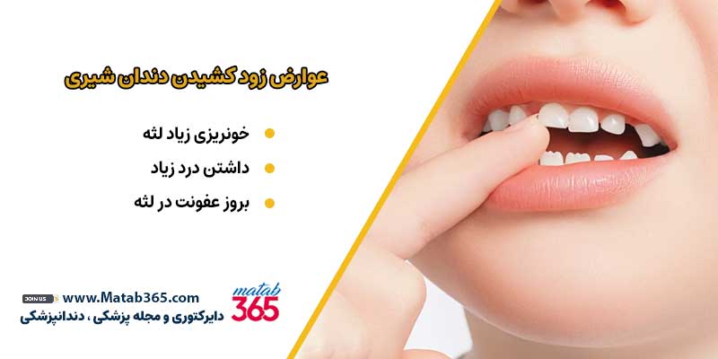 عوارض زود کشیدن دندان شیری | مطب 365