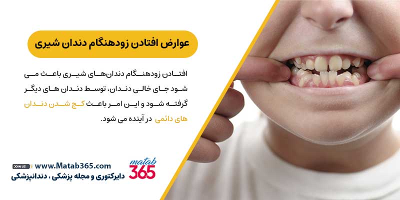 عوارض افتادن زود هنگام دندان شیری