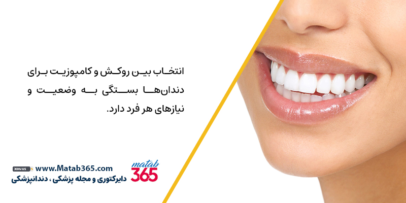 انتخاب بین روکش و کامپوزیت برای دندان‌ها بستگی به نیازهای هر فرد دارد.
