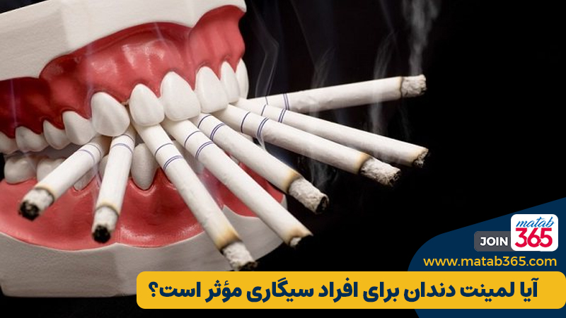 آیا لمینت دندان برای افراد سیگاری مؤثر است؟