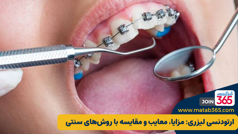 ارتودنسی لیزری: مزایا، معایب و مقایسه با روش‌های سنتی