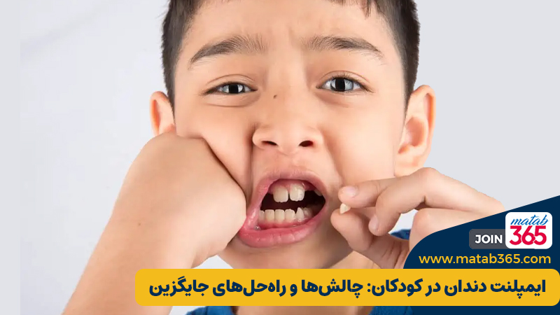 ایمپلنت دندان در کودکان: چالش‌ها و راه‌حل‌های جایگزین