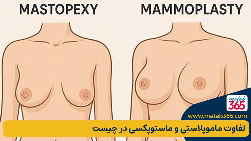 تفاوت ماموپلاستی و ماستوپکسی در چیست؟