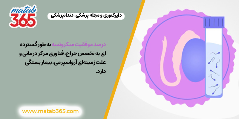 عوامل تعیینکننده موفقیت جراحی میکروتسه | مطب ۳۶۵