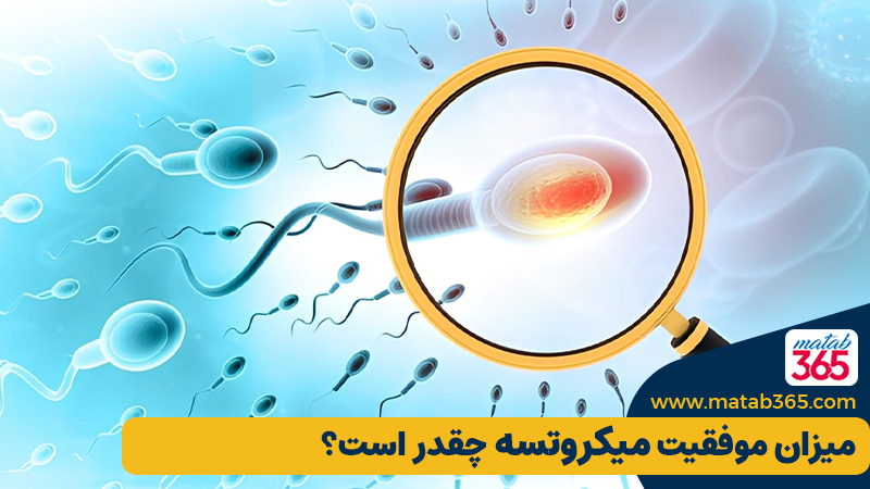 میزان موفقیت میکروتسه چقدر است؟ بر اساس آخرین تحقیقات علمی | مطب ۳۶۵