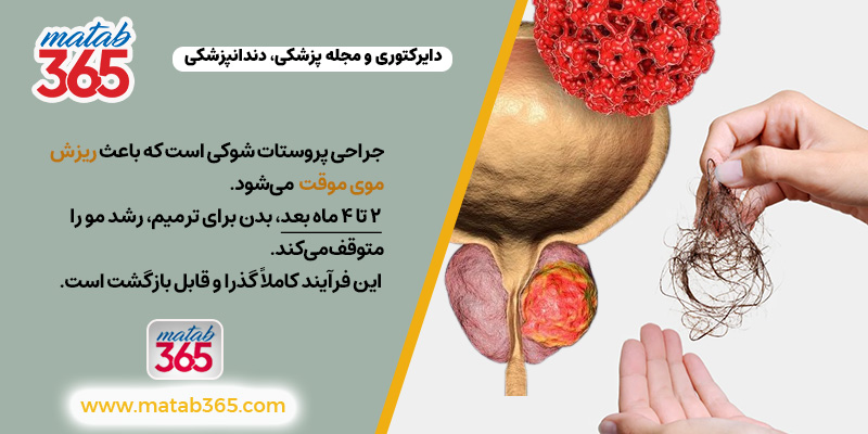 ریزش موی ناشی از برداشتن پروستات | مطب ۳۶۵