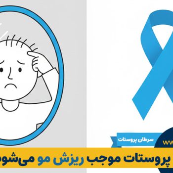 آیا سرطان پروستات موجب ریزش مو می‌شود؟ +بررسی کامل رابطه هورمونی و درمان‌ها | مطب ۳۶۵