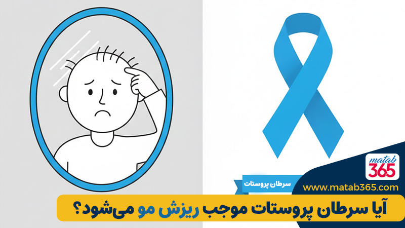 آیا سرطان پروستات موجب ریزش مو میشود؟ +بررسی کامل رابطه هورمونی و درمانها | مطب ۳۶۵